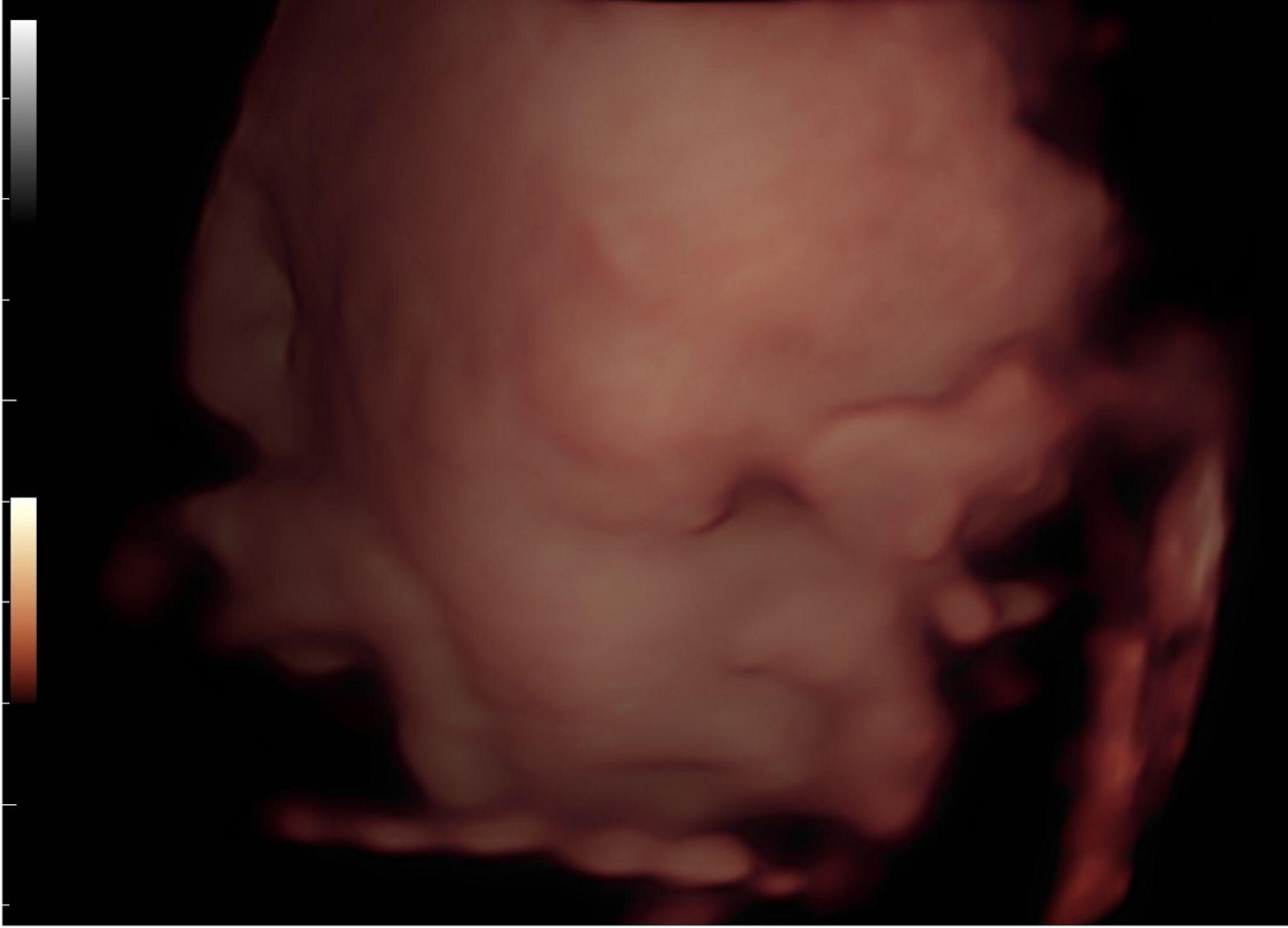 ecografia 3D em Lisboa melhores clínicas